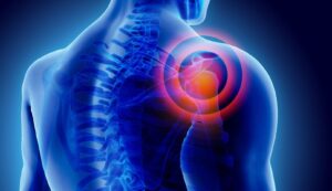 shoulder pain management